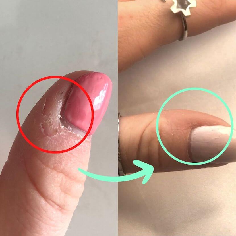 CalmComfort™ - Bague Antistress - 1 acheté = 1 offerte